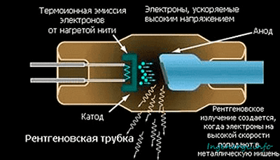 Что такое лучевая нагрузка на КТ и почему это важно